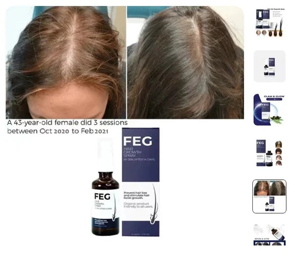 Hair Growth Spray |  رذاذ نمو الشعر